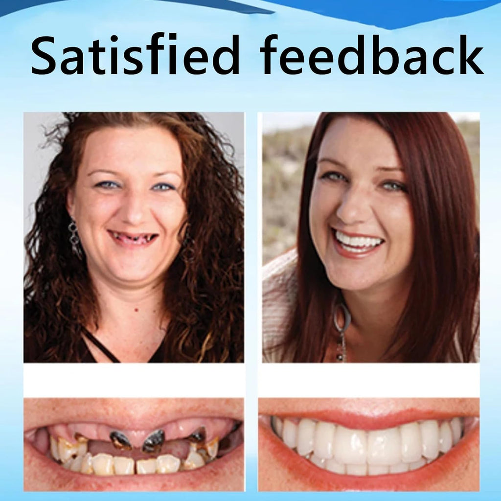 Bikenda Silicone Reline Denture Set - Secure & Comfortable Upper/Lower Dentures Repair Kit with Soft Silicone Material for Easy Adjustments